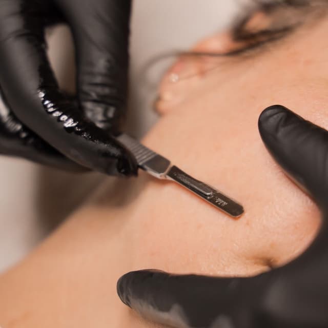 Signature Dermaplane Pass at Fae Esthetics in Raleigh, NC